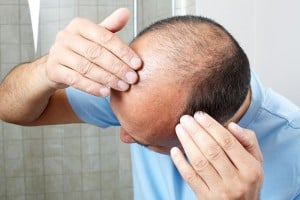 Hair loss.