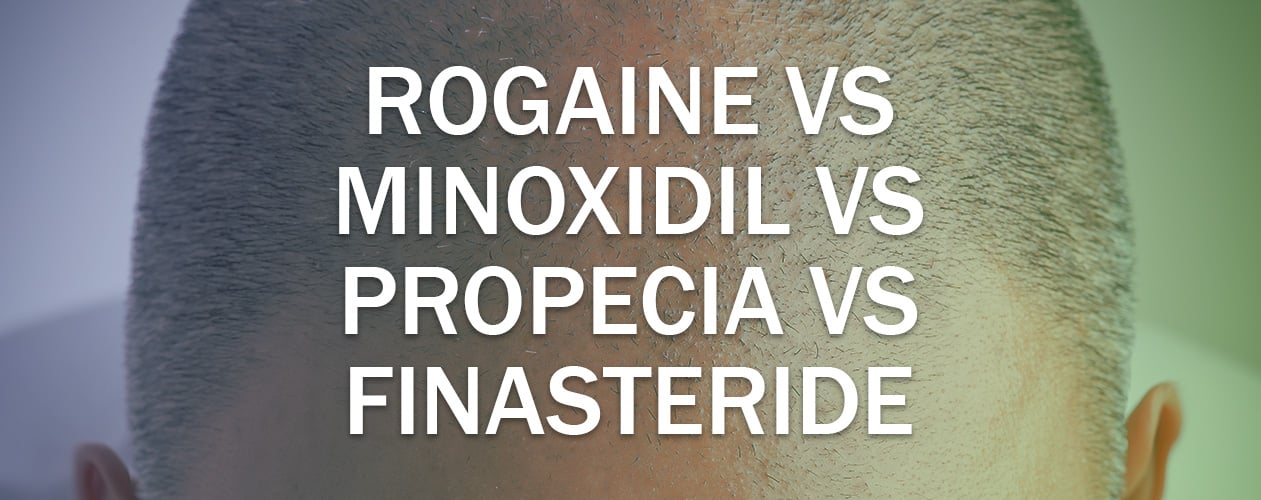 Regaine Minoxidil vs Propecia vs Finasteride -